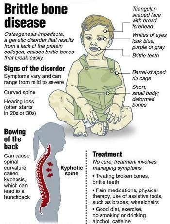 brittle bone disease life expectancy.